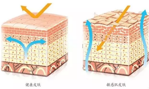 敏感肌膚與健康肌膚的對(duì)比，導(dǎo)致肌膚敏感的原因有哪些