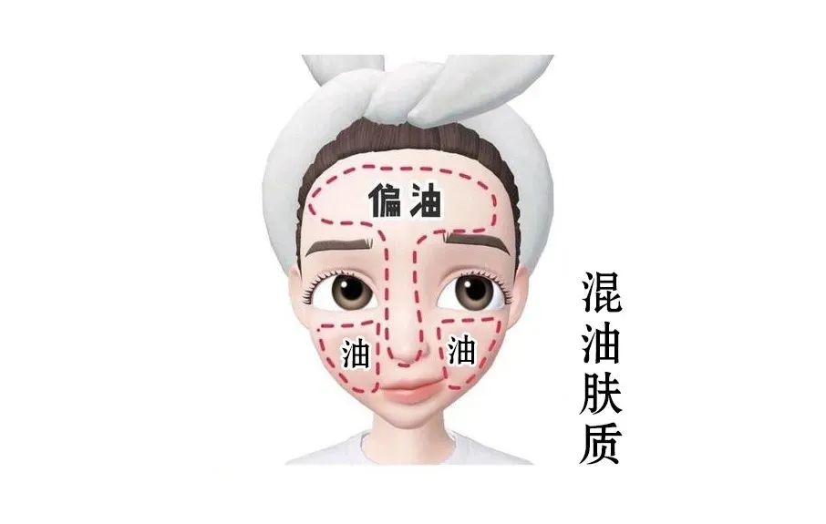 混合性皮膚如何護(hù)理效果好？