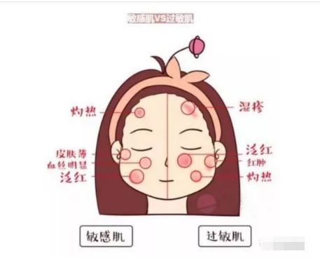 不同膚質(zhì)應(yīng)該如何正確護(hù)膚？