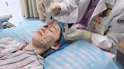 熱瑪吉有什么效果和副作用？