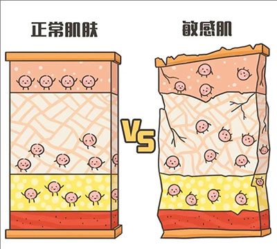 敏感性皮膚產(chǎn)生的原因是什么？
