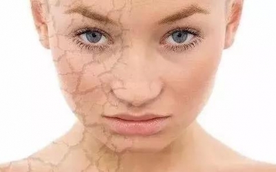 肌膚刺癢是什么原因？是哪些因素造成肌膚刺癢的現(xiàn)象？