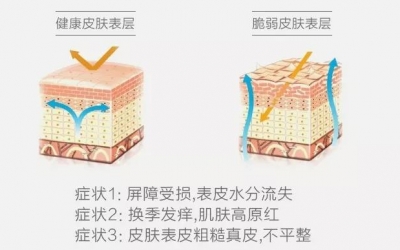 敏感肌與過敏肌的區(qū)別是什么？