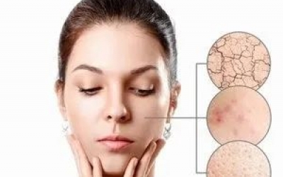 什么是春敏？如何預防春敏？