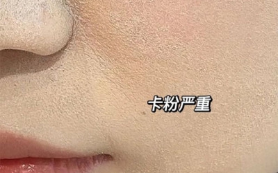 卡粉是什么意思？卡粉是什么原因引起的？
