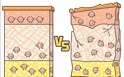 敏感性皮膚產(chǎn)生的原因是什么？